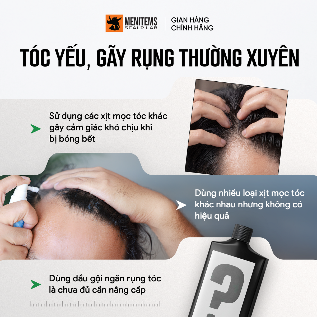 Xịt dưỡng hỗ trợ mọc tóc táo xanh