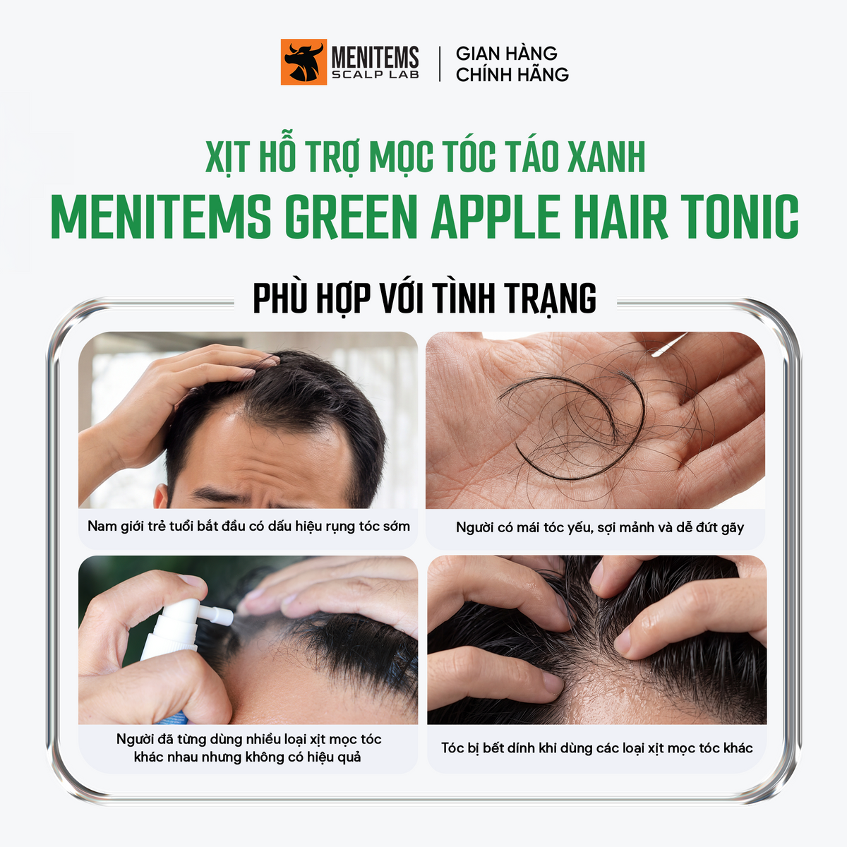Xịt dưỡng hỗ trợ mọc tóc táo xanh
