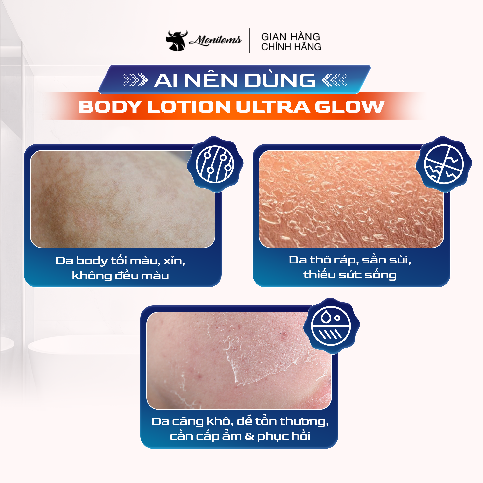 SỮA DƯỠNG THẾ BODY LOTION ULTRA GLOW